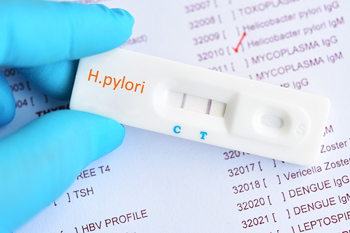 Test helicobacter pylori - Dra. Giovanna Parra Gil